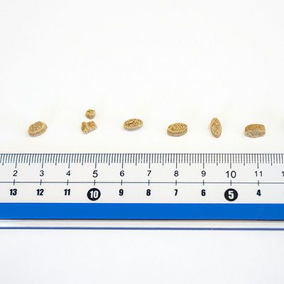 yum yum yum！ 健康マネジメント腎臓